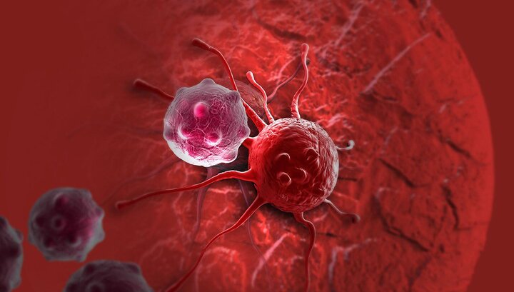 افزایش نگران‌کننده سرطان روده بزرگ در ایران