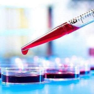 آزمایش خون می‌تواند بیماری کرون را پیش‌بینی کند
