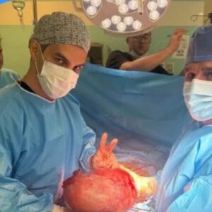 خارج‌سازی توده ۷ کیلویی تخمدان از شکم بیمار ۴۷ ساله