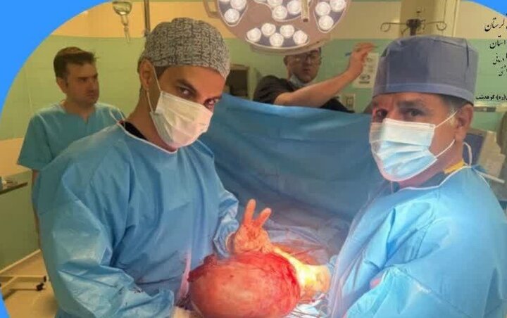خارج‌سازی توده ۷ کیلویی تخمدان از شکم بیمار ۴۷ ساله